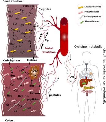 The putative role of gut microbiota in cancer: Cysteine is a pivotal coin
